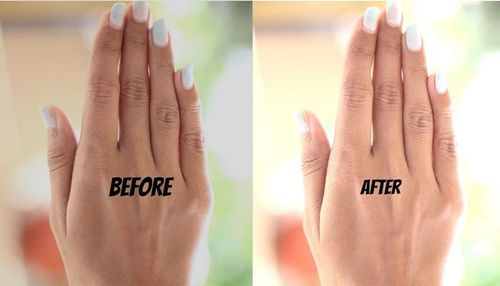 How to Remove Sun Tan Immediately